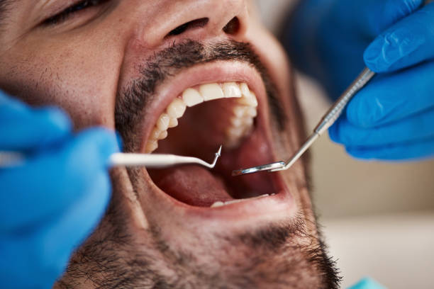 Best Dental Fillings (Composite and Amalgam)  in Atlanta, IL